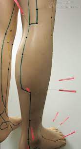 Pin On Acupunture