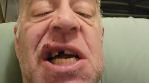 Fundraiser by NEIL BLISS : Dental Surgery