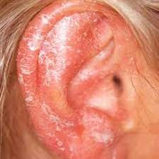 Pin On Natural Remedies