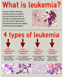 The different types of leukemia are varied in their presentation, age of onset, risk factors and outlook. 7 553 Likes 44 Comments Medical Doctors Worldwide Medical Doctors On Instagram Types Of Medical Laboratory Science Medical Laboratory Oncology Nursing