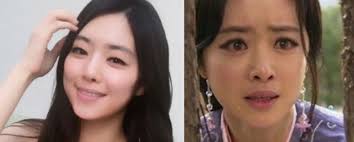 Not only eyelid surgery, her perfect nose bridge is also the product of plastic despite the cosmetic surgery, park min young's face and expression are not stiff but still very natural. Actress Hong Soo Ah Denies Plastic Surgery Rumors Kissasian