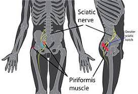 Likewise, there are muscles in other parts of the body that help support and move the spine. Piriformis Syndrome Wikipedia
