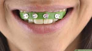 But do you know how to tell them apart from the legit as it turns out a whopping 45.4% of you agree that diy braces are the most dangerous beauty hack (yes. How To Make Fake Braces 11 Steps With Pictures Wikihow