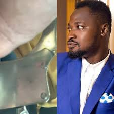 What Funny Face Told The Judge Which Landed Him In A Psychiatric Hospital  Revealed (Video)