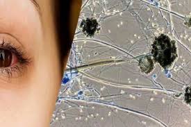 إذا رأى الشخص في منامه أنه يقوم ببيع القط الأسود دل ذلك على أن هذا الشخص سوف يخسر الكثير من ماله دون أن يشعر وسوف يكون الشخص فقير جداً. Ø¹Ø¯ÙˆÙ‰ Ø§Ù„ÙØ·Ø± Ø§Ù„Ø£Ø³ÙˆØ¯ ÙƒÙ„ Ù…Ø§ ØªØ±ÙŠØ¯ Ù…Ø¹Ø±ÙØªÙ‡ Ø¹Ù† Ø§Ù„Ø¹Ù„Ø§Ù…Ø§Øª ÙˆØ§Ù„Ø£Ø¹Ø±Ø§Ø¶ ÙˆØ·Ø±Ù‚ Ø§Ù„Ø¥ØµØ§Ø¨Ø©