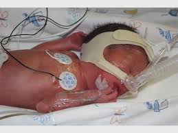If a woman giving birth dies before the baby is out, how will the doctors handle it? Ekurhuleni Mom Gives Birth To Five Babies She Was Expecting Three The Citizen