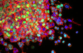 Cancer is caused by certain changes to genes, the basic physical units of inheritance. How Ai Could Spot Lung Cancer Sooner And Save Lives Nvidia Blog