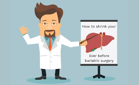 How Can I Tell If My Liver Is Shrinking Before My Bariatric Surgery Perform stomach surgery on this young boy before it's too late. how can i tell if my liver is shrinking