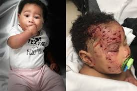 Good for you, before a raccoon attacks, they'll usually give off physical body language before they go into full fight mode. Let S Not Let A Raccoon Attack Spoil A Baby S First Christmas
