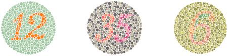 Color blindness is simply a vision problem a person who is color blind is said to live as long a life as someone who has normal vision. Diagnosis