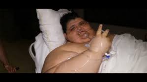 Pharmacist, marketer, geek, optimistic and catholic. World S Heaviest Man Recovering From Bariatric Surgery Wthr Com