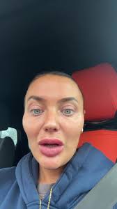 Understanding Amytriptyline: Experiences and Insights