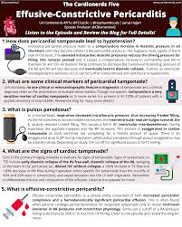 Image result for Pericarditis