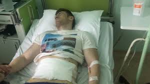 Are doar 1 cm, oare sunt sanse sa scap fara operatie laparoscopica? M Am Operat De Hernie InghinalÄƒ DupÄƒ Cat Timp Pot Merge La SalÄƒ Youtube