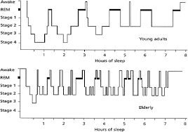 Oct 03, 2019 · ideal room temperature for elderly adults cold rooms are dangerous. Insomnia In The Elderly Cause Approach And Treatment The American Journal Of Medicine