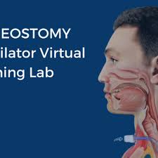Tracheostomy Tube Sizes And Comparison Tool
