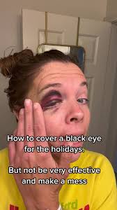 Tbh I probably made it worse #blackeye #blackeyecoverup #makeuptutorial  #makeuptips