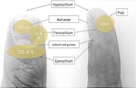 Image result for paronychium