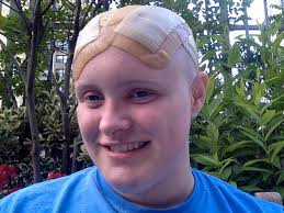 Tourette Syndrome Patient: My Life With a Brain Implant