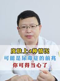 尿毒症- 抖音百科