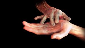 Image result for Anhidrosis