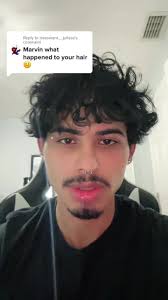 True Story: My Hair Fell Off TikTok