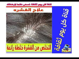 علاج القشره و التخلص من القشرة خلطة رائعة قشرة الرأس علاج القشره و علاج قشرة الشعر
