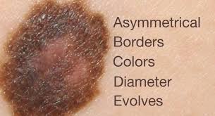 Learn more about naturally derived sunscreens and which ingredients to look for to better protect your first of all, the sun does not cause cancer; Do Sunscreens Cause Cancer Science Based Medicine