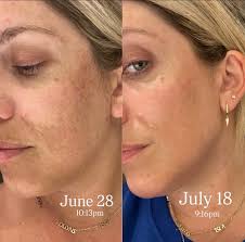 First time back to the beach after 8 weeks