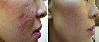 Pin On Dermatology