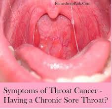Signs and symptoms of laryngeal cancer include a sore throat and ear pain. Cancer Of The Throat Caused By Hpv Hpv Mouth Cancer Symptoms