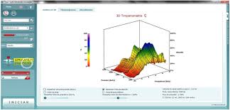 A doença de ménière afecta a orelha interna e é caracterizada por ataques da vertigem, do tinnitus, da perda da audição e dos sentimentos da pressão dentro da orelha. Analysis Of Wideband Tympanometry In Meniere S Disease Sciencedirect