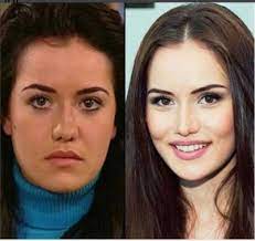 Ünlü oyuncu fahriye evcen, estetik yaptırdığı iddialarına cevap verdi. Fahriye Evcen Den Estetik Iddialarina Yalanlama Geldi Eski Fotograflar Arsivlerden Cikti Sizce Unlu Oyuncu Estetik Yaptirmis Mi Kizlarsoruyor