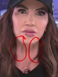 She's hiding her horrific new procedure