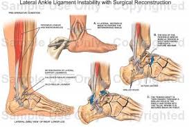 Lateral Ligament Reconstruction Ankle Google Search Ankle Anatomy Ankle Ligaments Medical Posters