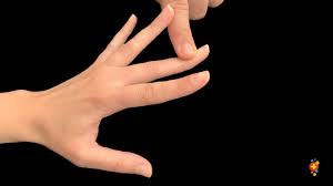 Image result for Elson Extensor Tendon Test