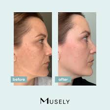 Musely the spot cream reviews. Facebook