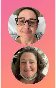 Luis was 42 years old and a busy life. I ate fast, slept poorly and always  said I didn't have time “even to go to the bathroom”. At first it was 2,