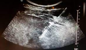 If your cat is eating less but seems to be bulking up, take a trip to the vet, says rocha. Liver Tumors And Cancers Mar Vista Animal Medical Center