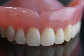 How to maintain clean and good looking dentures is a common question asked by all the patients who get dentures done. 4 Signs It S Time To Replace Your Dentures
