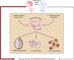 Sex differences in sleep apnea and Alzheimers Disease: role of  cerebrovascular dysfunction | npj Womens Health