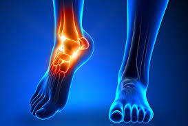 13 Types of Foot and Ankle Injuries That Shouldn't Be Ignored - Island Foot  Clinics