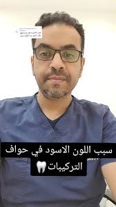 Replying to @maturity.aziz سبب اللون الاسود حول #التركيبات #مكة #جدة  #dental #الأسنان #veneer #restoration