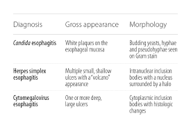 Ulcers contain necrotic debris and exudate with neutrophils. Usmle Step 2 Determine The Cause Of Pain And Weight Loss American Medical Association