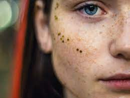 Auch nach fast 150 jahren lässt sich diese aussage noch immer au. Pickel Im Gesicht Das Verrat Die Lage Des Pickels Uber Deine Gesundheit Aus