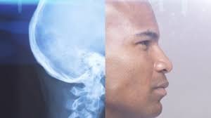 Medical Radiation Risks: 6 Facts You Need to Know