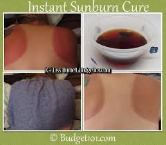 Instant Sunburn Relief Cure How To Fix A Painful Sunburn And Turn It Into A Painless Tan With This Tri Cure For Sunburn Sunburn Relief Health And Beauty Tips