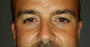 Topnotch Resort hires Gleason