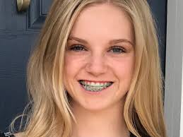 Fundraiser by Jessica Blackwell : Bryn's Anterior Scoliosis Correction  Surgery