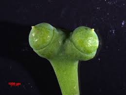 イチョウ の 雌花